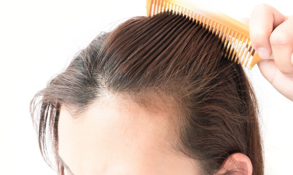Rawatan Pembetulan Tanam Rambut dengan sikat rambut di tanam rambut Malaysia